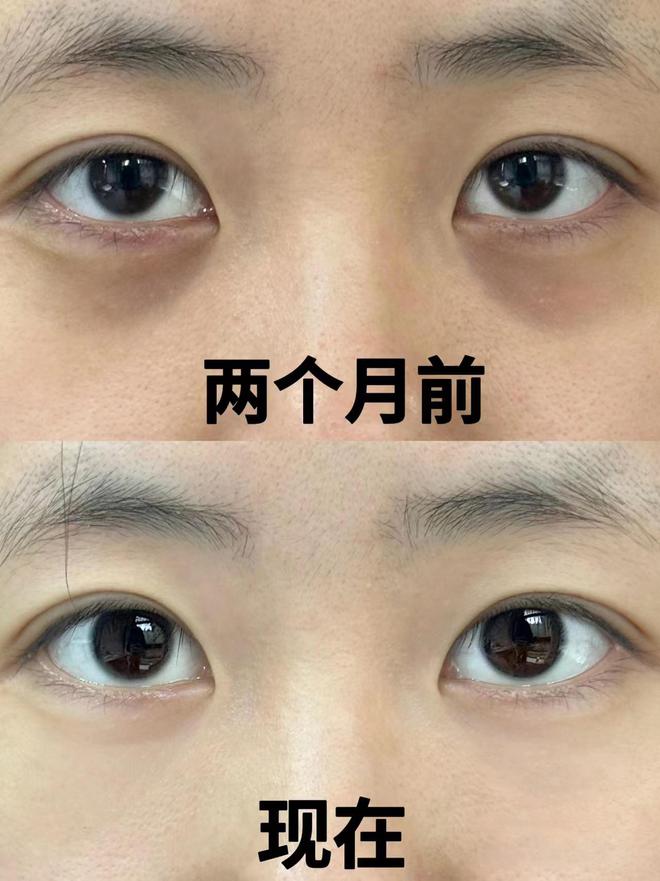 眼霜哪个牌子抗皱去皱效果最好？宿舍十款抗皱眼霜大比拼(图3)