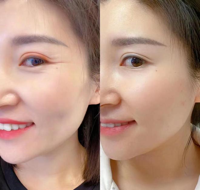 眼霜抗皱去细纹第一名！秋冬季认真挑选的抗皱眼霜分享(图3)