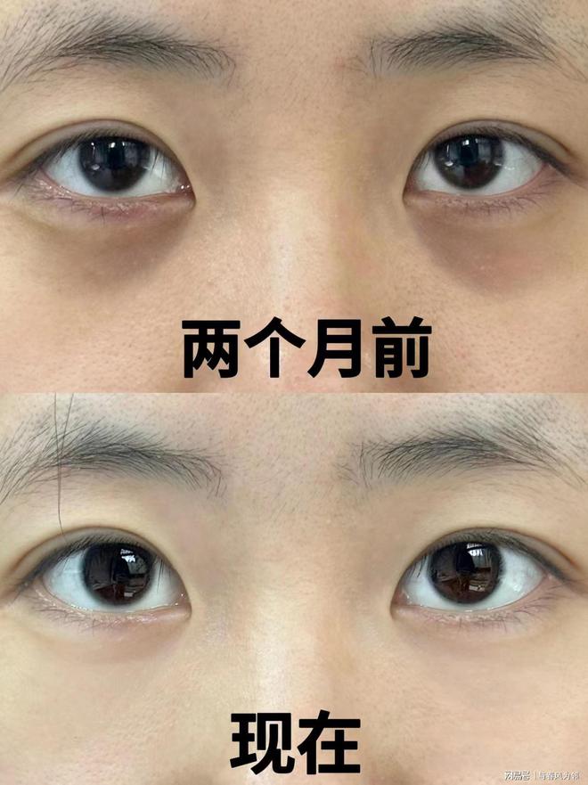 半岛Bandao体育干货总结分享：抗皱眼霜哪个牌子的效果好？十款抗皱眼霜推荐(图3)